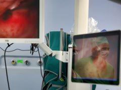 Szeged, okos cochleáris implantátum beültetés, műtét, Szegedi Tudományegyetem, SZTE, Fül- Orr- Gégészeti és Fej- Nyaksebészeti Klinik, hallókészülék, műtő, klinika, egészségügy