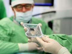 Szeged, okos cochleáris implantátum beültetés, műtét, Szegedi Tudományegyetem, SZTE, Fül- Orr- Gégészeti és Fej- Nyaksebészeti Klinik, hallókészülék, műtő, klinika, egészségügy